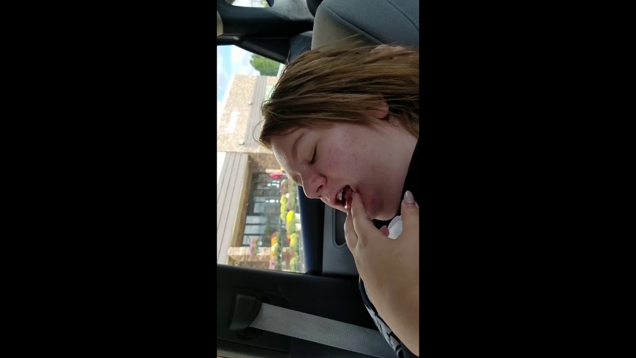 PLEASE LAUGH AT ME (WISDOM TEETH VIDEO)