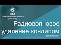 287  Радиоволновое удаление кондилом