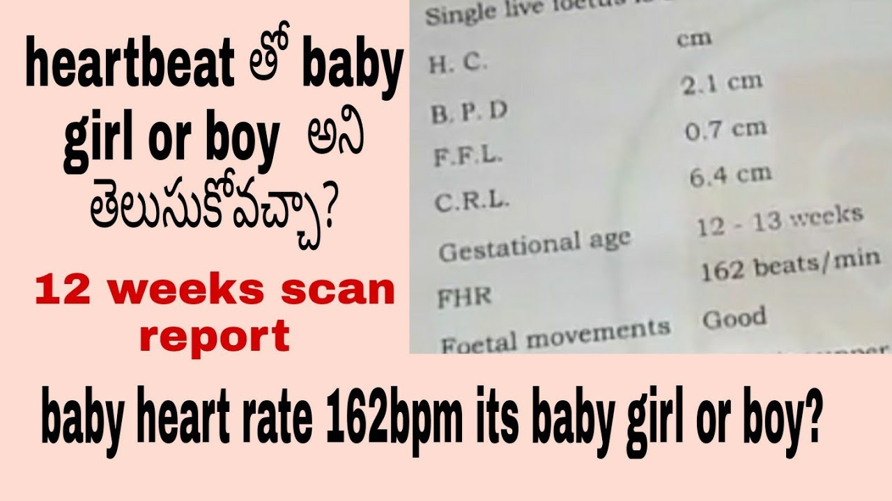 fetal heart rate boy or girl chart