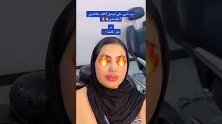 النتيجة بعد شهر على عملية تجميل الأنف بالتخدير الموضعي و فلر الشفه مجمع النور الطبي