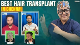 Details Best Hair Transplant in Chennai | Real Before After Results | Expert Hair Transplant Clinic Guide
