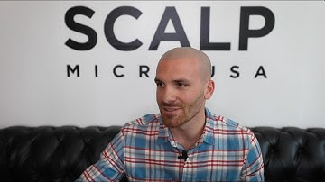 Matt’s AWESOME Scalp Micropigmentation Transformation | Scalp Micro USA