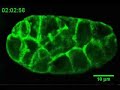 Glow Worm: Green Fluorescent Proteins light up C. elegans