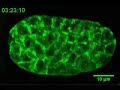 Glow Worm: Green Fluorescent Proteins light up C. elegans