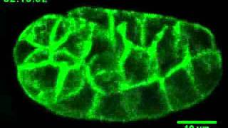 Glow Worm: Green Fluorescent Proteins light up C. elegans