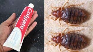MAGIC INGREDIENT || How To Kill Bed Bugs JUST ONE MINUTE || EASY TIPS ||  HOME REMADY