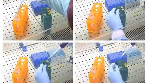 FY 263 Ex Vivo Imaging of Resident CD8 T Lymphocytes in Human Lung Tumor Slices Using Confocal Micro