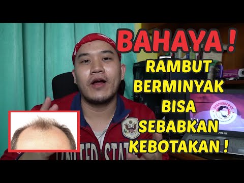 Video: Cara Menghilangkan Kulit Kepala Dan Rambut Berminyak: 16 Rawatan Rumah