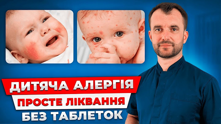 День 2. Алергія у дитини пройде НАЗАВЖДИ! Правильне лікування алергії у дитини без таблеток