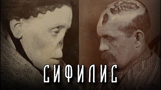 СИФИЛИС | История Самой Позорной Болезни