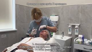 Фотоомоложение лица + биоревитализация в один приём. Врач: Тараканова Т.В.