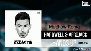 Hardwell & Afrojack feat. Matthew Koma  - Hands Up Vs. Dare You (Cesc7 Mashup)