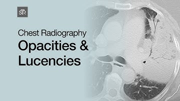 Chest Radiography: Opacities & Lucencies