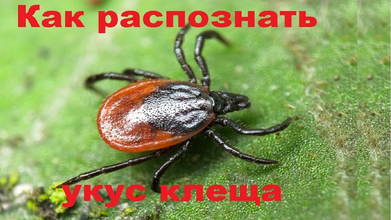 Укус энцефалитного клеща: симптомы и последствия Укус энцефалитного клеща: симптомы и последствия