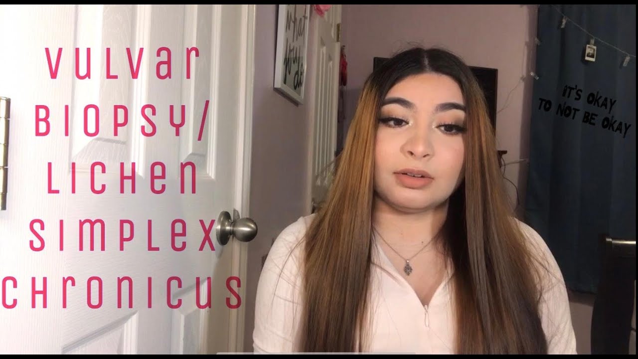 Vulvar Biopsy/Lichen Simplex Chronicus Journey