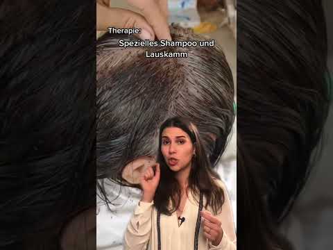 Video: Hilft das Glätten der Haare gegen Läuse?
