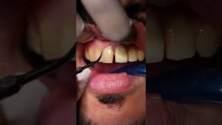 د.هبه قطب / اخصائي علاج تحفظي تجميل dentalclinic smile explore اسنان dentist تقويم_اسنان