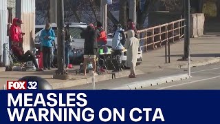 Health department warns of CTA, suburban Walmart measles exposure