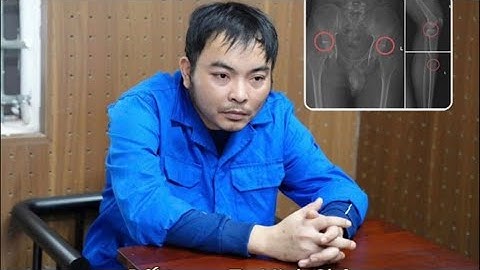 Kể chuyện cảnh giác: Số 5 - Trục lợi Bảo hiểm