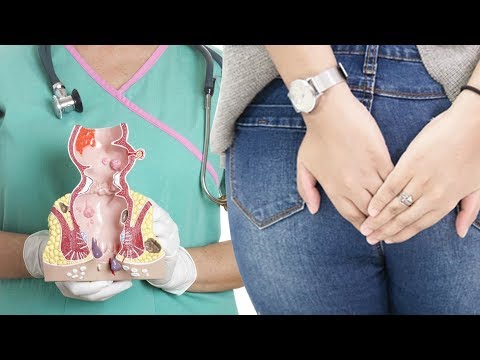 What Is Blood In Anus? | What Are The Most Common Causes Of Anal Bleeding? | Health and Beauty