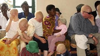 Malawi : les albinos manifestent devant le Parlement