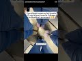 #medical #usnurse #medicalshorts #nurse #medicaldoctor
