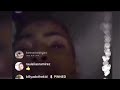 XXXTentacion’s Instagram LIVE with BillyADotTheKid (Rare)