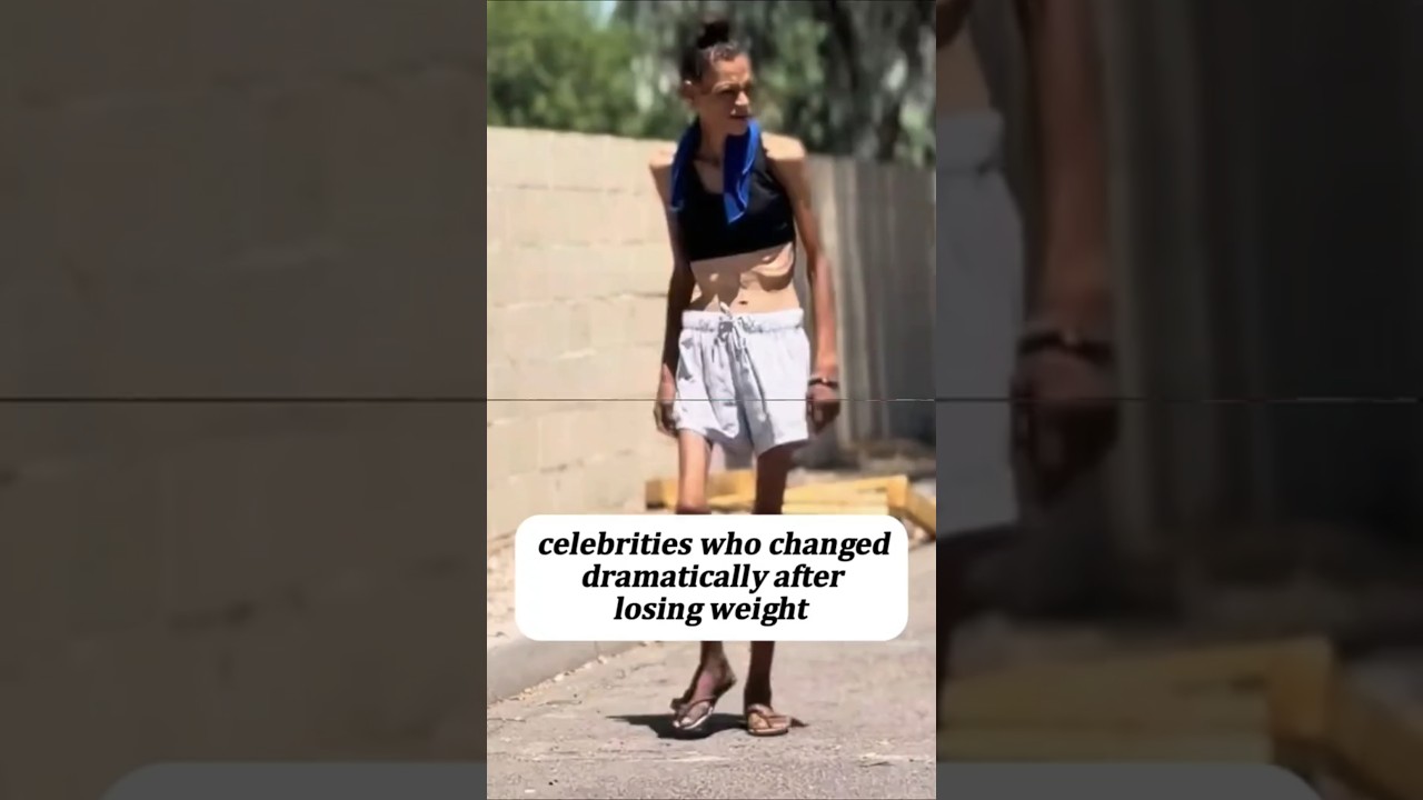celebs who changed dramatically after losing weight 