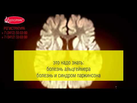 Видео: Понимание деменции Паркинсона и Паркинсона