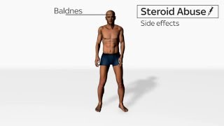 Steroid side effects