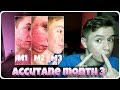 Accutane Mood Swings