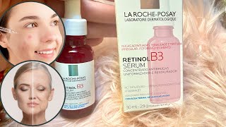 الريتينول لبشرة صافية وعدو التجاعيد -معالج لحب شباب و شحوبة البشرة Retinol B3 Serum La Roche Posay