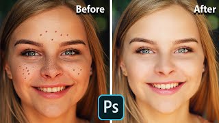 Photoshop Tutorial - How to Quickly Smooth Skin and Remove Blemishes & Scars