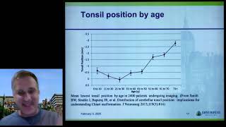 100 Most Common Chiari Questions - Dr. Eric Jackson