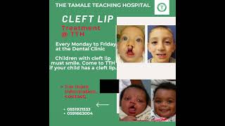 Cleft lip treatment at the Tamale Teaching Hospital