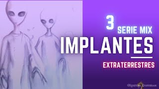 Implantes Extraterrestres Video 3《