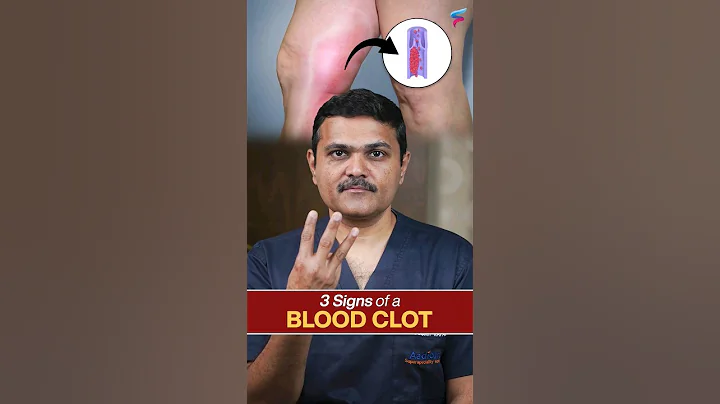Blood Clot ALERT! Catching It Early Saves Lives #vascularsurgeon #shortsviral