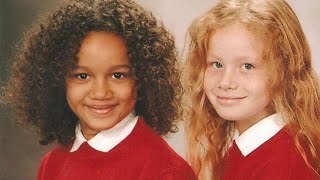 Remember These Rare Twins With Different Skin Colors? This is How They Look Now!