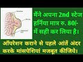 #hernia ka gharelu upchar #inguinal hernia treatment #BasicsWithLogic #Ep 6