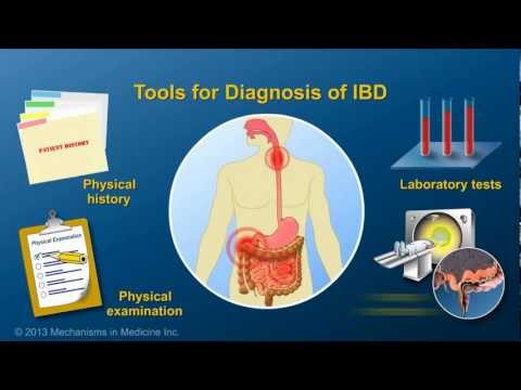 Diagnosing IBD