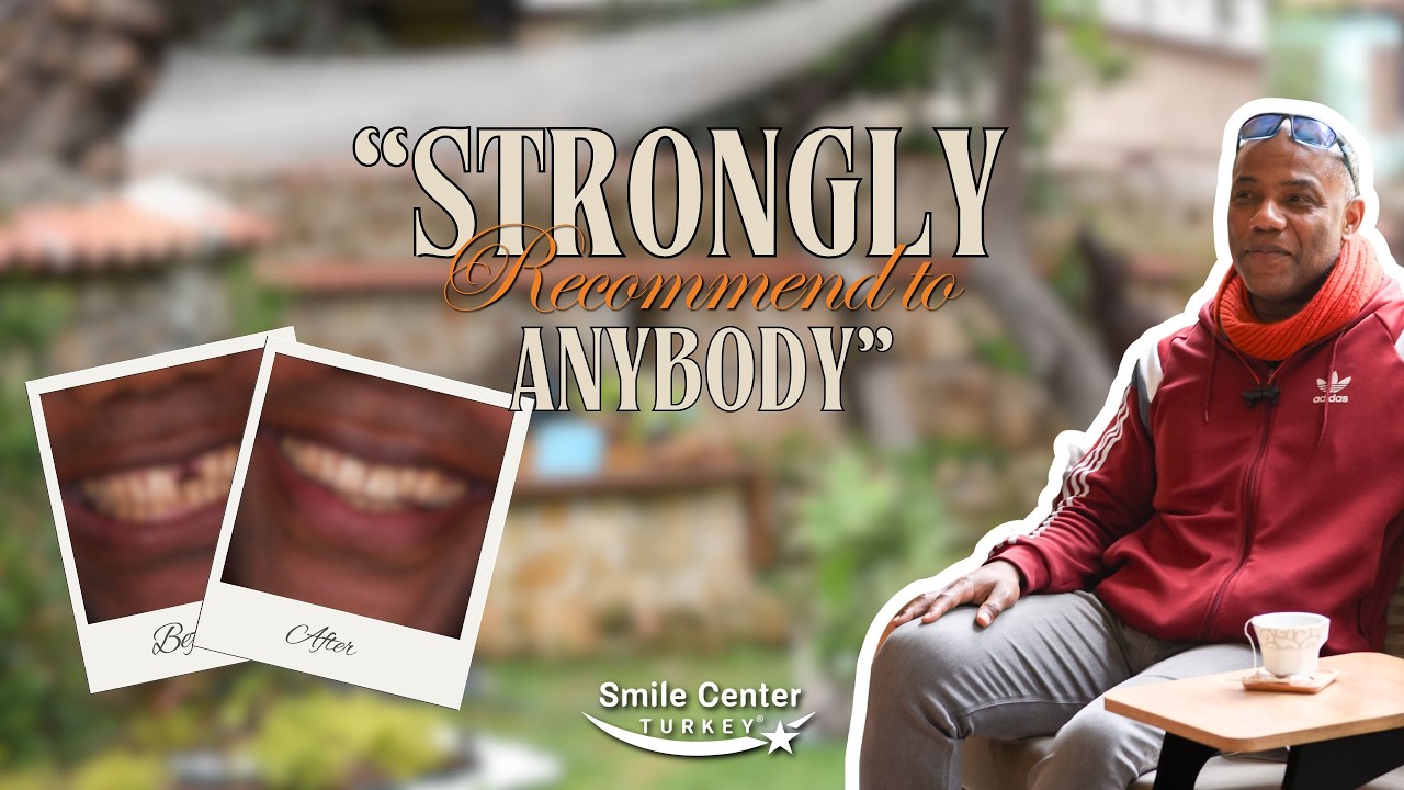 The Best Clinic For Dental Veneers Treatment In Antalya, Turkey