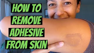 How to Remove Adhesive from Skin