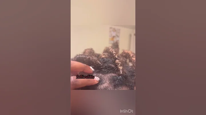 Protective style on Locs gone wrong, full video on...