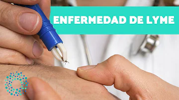 ¿Qué ocurre si la enfermedad de Lyme no se trata de inmediato?