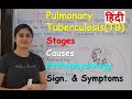 Pulmonary Tuberculosis in Hindi | Stages | Causes | Pathophysiology | Sign. & Symptoms