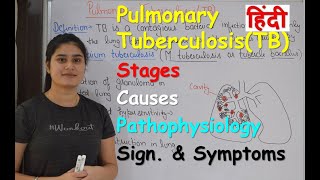 Pulmonary Tuberculosis in Hindi | Stages | Causes | Pathophysiology | Sign. & Symptoms