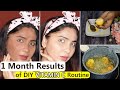 मैं हैरान हूं How Vitamin C Routine Changed my skin! सालों पुरानी Pigmentations झाइयां हो गयी ख़तम