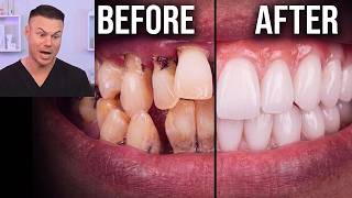 The Craziest Dental Transformation Ever!