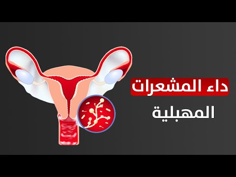 فيديو: طلب عرض أسعار اشتراك في طلب عرض أسعار. طلب عروض أسعار تحت 44 منطقة حرة