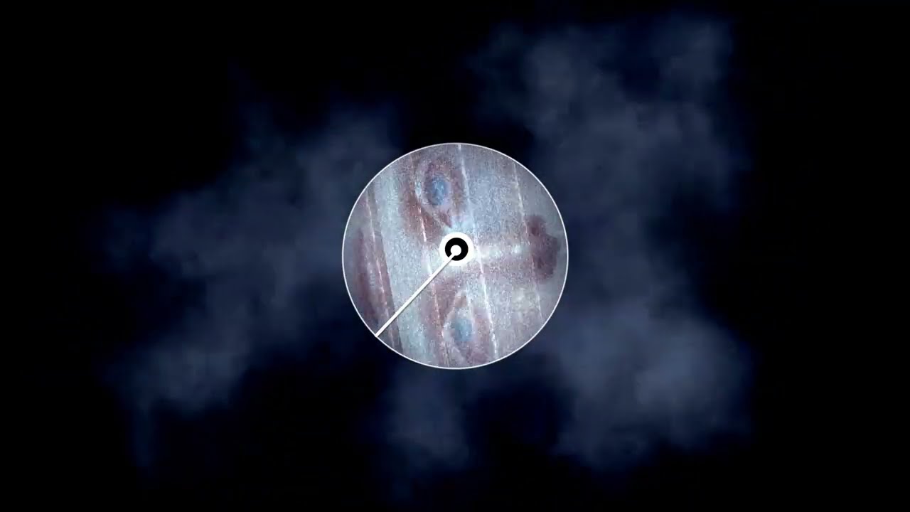 Mira Deren - Neden? ( Official Music )